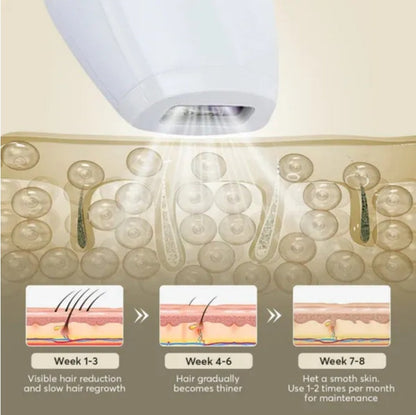 Professional Laser Epilator – IPL Hair Removal for Body, Bikini, and Legs -90000 flashes