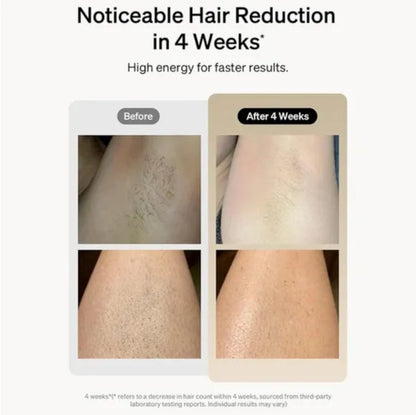Professional Laser Epilator – IPL Hair Removal for Body, Bikini, and Legs -90000 flashes